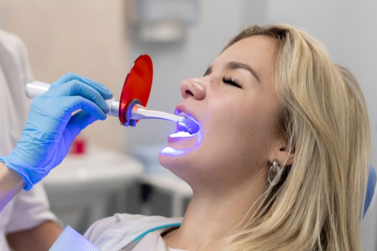 teeth whitening in bentonville