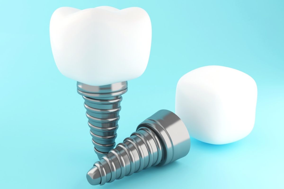 dental implants in Bentonville