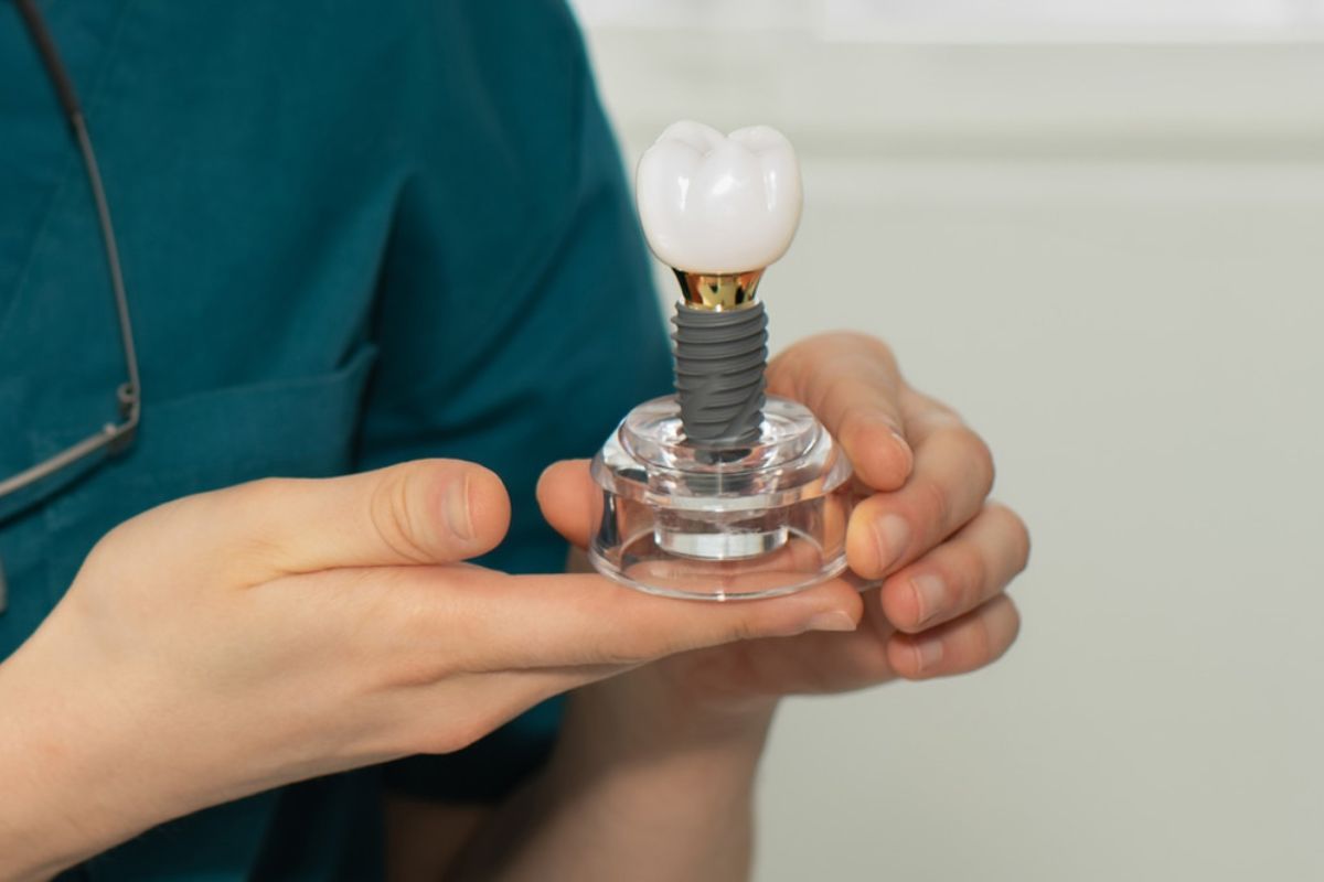 Dental Implants in Bentonville