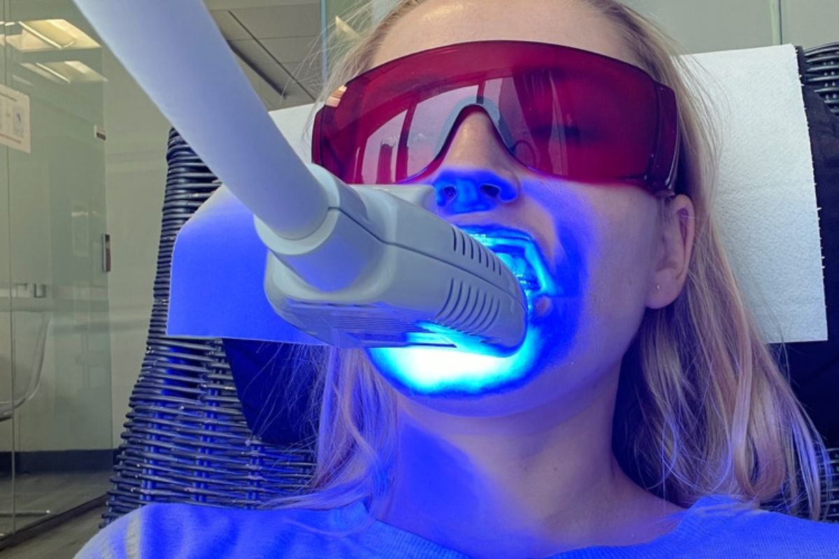 teeth whitening in Bentonville