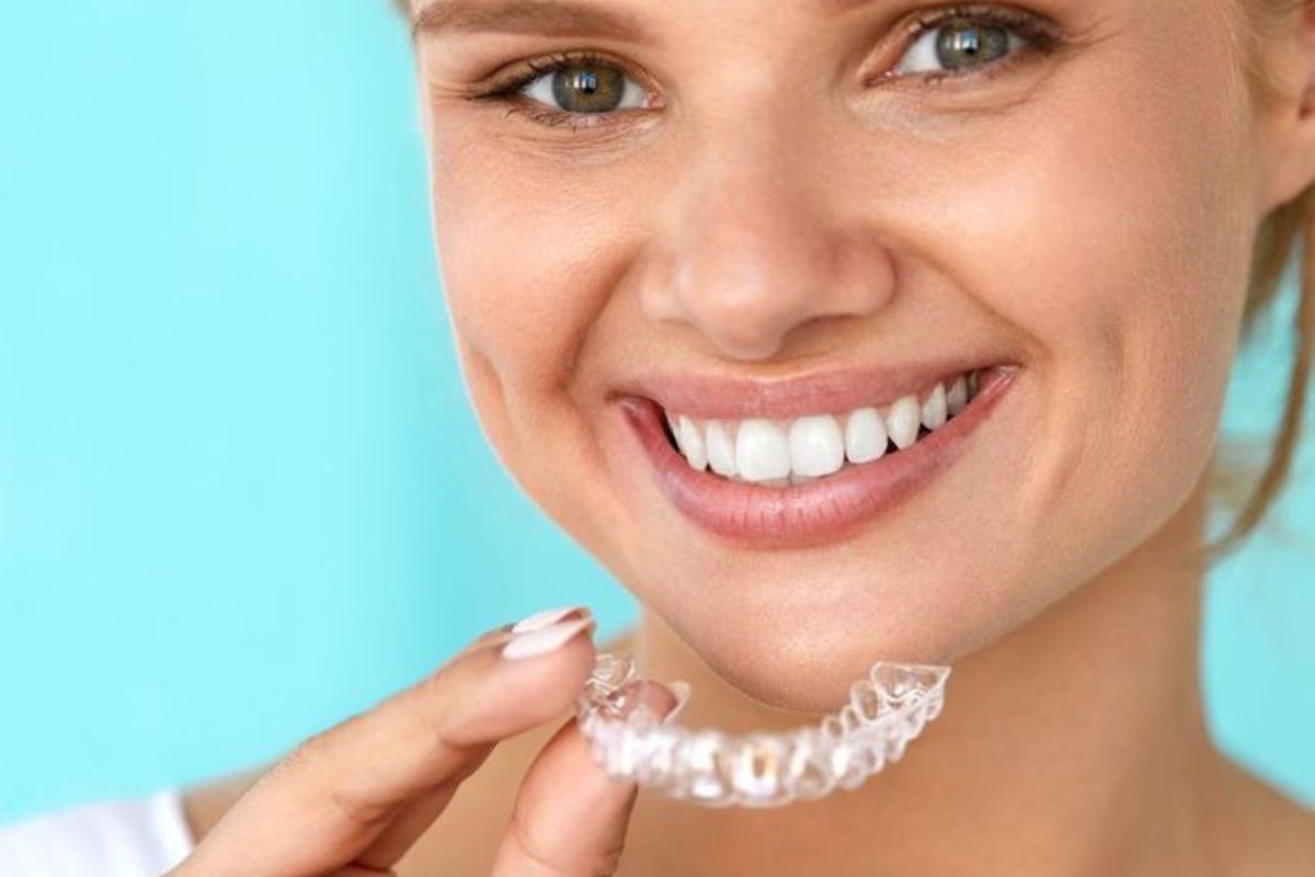 will-invisalign-work-for-minor-relapse-after-braces